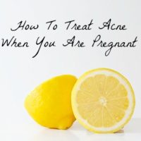 How to treat acne when you are pregnant